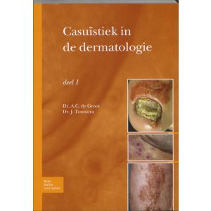 casuïstiek-in-de-dermatologie-deel-1-9789031361885