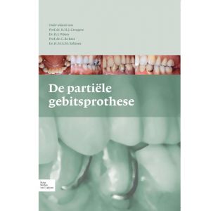 de-partiele-gebitsprothese-9789031375752