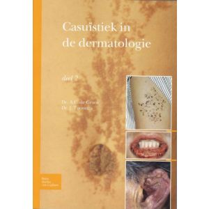casuïstiek-in-de-dermatologie-9789031384570