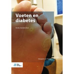 voeten-en-diabetes-9789036802789