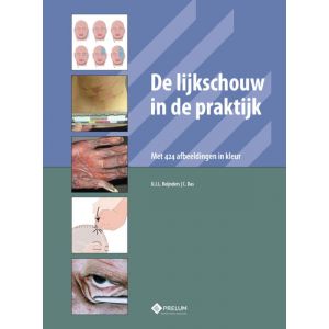 de-lijkschouw-in-de-praktijk-9789085621508
