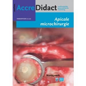 apicale-microchirurgie-9789089763600